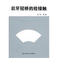 大川分享_总义齿的合接触：五种不同合型的设计要点