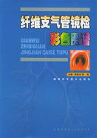 电子支气管镜检查图谱.128