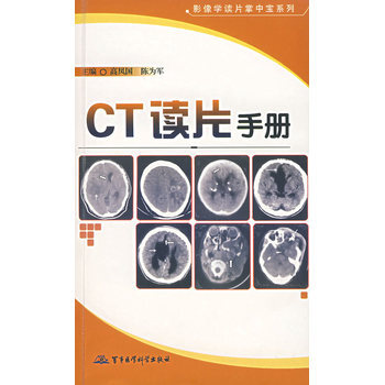 常用CT征手册