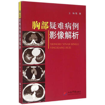 甲状腺疑难病例影像解析_田兴松主编2021年彩图