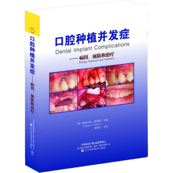 口腔种植并发症 病因预防和治疗 章锦才译年彩图