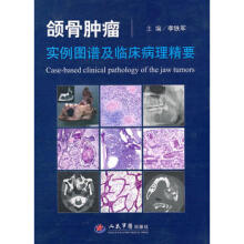 大川分享_颌骨肿瘤实例图谱及临床病理精要