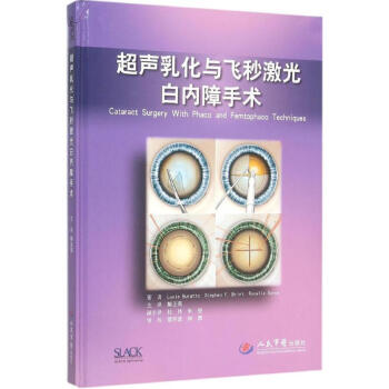白内障超声乳化手术学